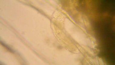 Canlılar arasında köhne su mikroskobik görünümü. Wrotek