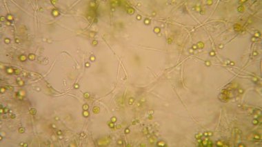 Canlılar arasında köhne su çürümüş bitki örtüsü ile mikroskobik görünümü. Euglena Viridis 