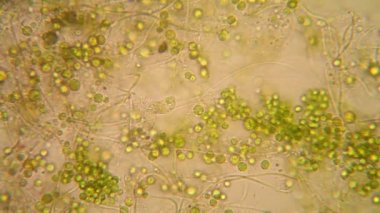 Canlılar arasında köhne su çürümüş bitki örtüsü ile mikroskobik görünümü. Euglena Viridis 