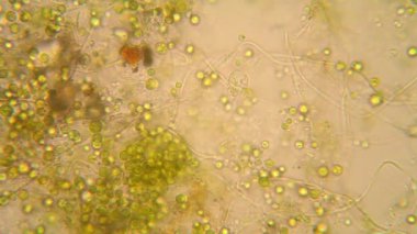 Canlılar arasında köhne su çürümüş bitki örtüsü ile mikroskobik görünümü. Euglena Viridis 