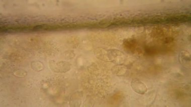 Canlılar arasında köhne su çürümüş bitki örtüsü ile mikroskobik görünümü. Terliksi hayvan caudatum 