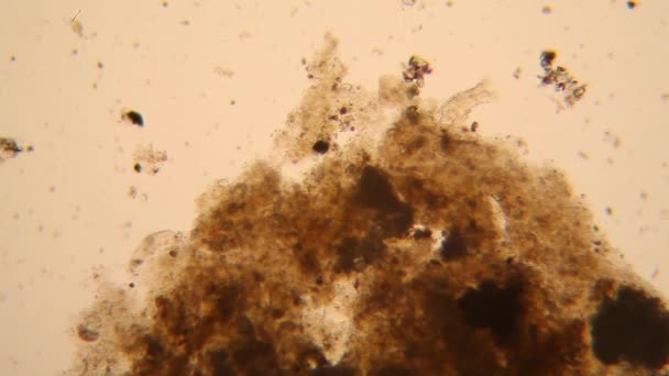 Mikroskopischer Blick Auf Organismen Verschwommenen Wasser Rotiferen — Stockvideo