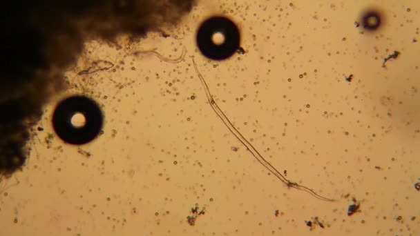 Vue Microscopique Des Organismes Dans Eau Bouillante — Video