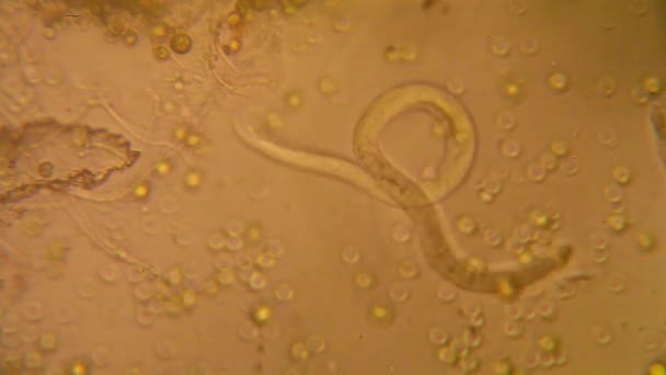 Vue microscopique des organismes dans l'eau bouillante  