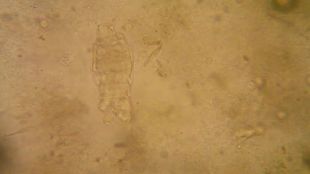 Microscopic View Organisms Fusty Water Rotifers — Stock Video