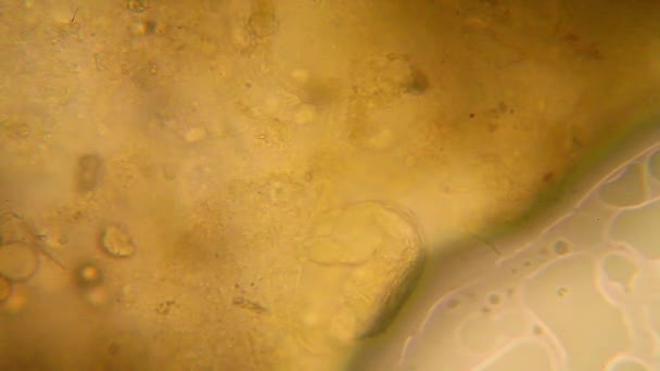 Obraz Mikroskopowy Organizmów Wodzie Stęchły Wrotek — Wideo stockowe