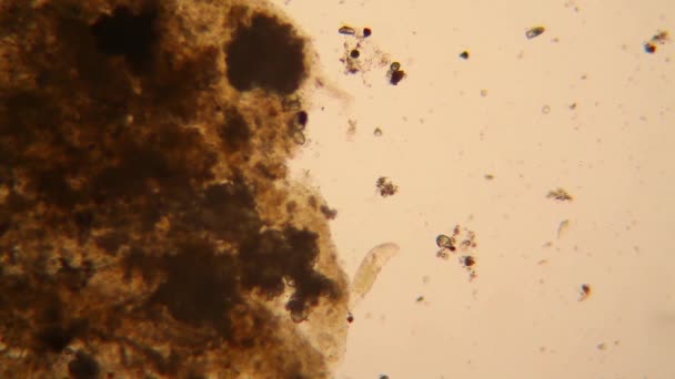 Mikroskopisk Syn Organismer Det Rustne Vannet Rotifers – stockvideo