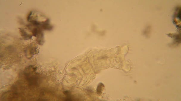 비공식 미세한 있습니다 Rotifers — 비디오