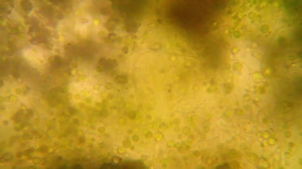 Visão Microscópica Organismos Água Fervente Rotifers — Vídeo de Stock