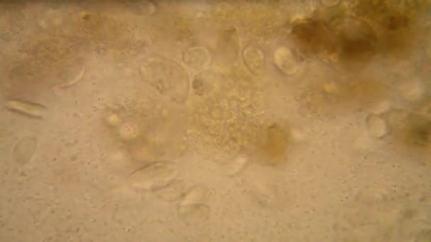 Μικροσκοπική Άποψη Οργανισμών Στο Μπαγιάτικος Νερό Σάπια Βλάστηση Paramecium Caudatum — Αρχείο Βίντεο