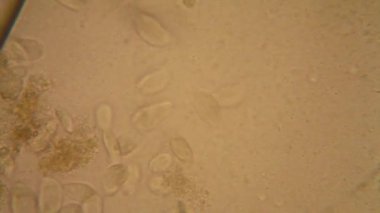 Canlılar arasında köhne su çürümüş bitki örtüsü ile mikroskobik görünümü. Terliksi hayvan caudatum 