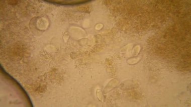 Canlılar arasında köhne su çürümüş bitki örtüsü ile mikroskobik görünümü. Terliksi hayvan caudatum 