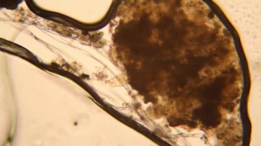 Canlılar arasında köhne su mikroskobik görünümü. Wrotek