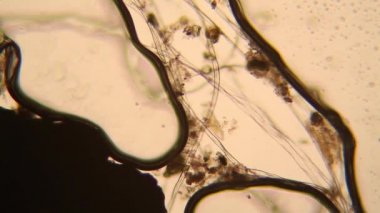 Canlılar arasında köhne su mikroskobik görünümü. Wrotek