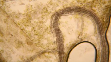 Canlılar arasında köhne su çürümüş bitki örtüsü ile mikroskobik görünümü. Terliksi hayvan caudatum