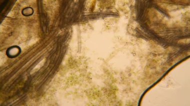 Canlılar arasında köhne su çürümüş bitki örtüsü ile mikroskobik görünümü. Terliksi hayvan caudatum