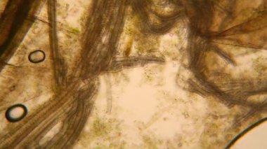 Canlılar arasında köhne su çürümüş bitki örtüsü ile mikroskobik görünümü. Terliksi hayvan caudatum