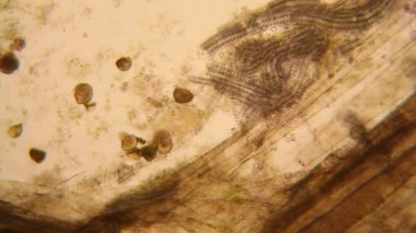 Canlılar arasında köhne su çürümüş bitki örtüsü ile mikroskobik görünümü. Terliksi hayvan caudatum