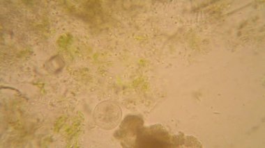 Canlılar arasında köhne su çürümüş bitki örtüsü ile mikroskobik görünümü. Terliksi hayvan caudatum