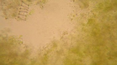 Canlılar arasında köhne su çürümüş bitki örtüsü ile mikroskobik görünümü. Terliksi hayvan caudatum