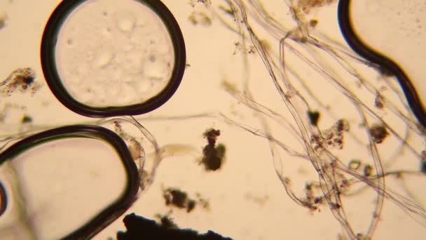 カビの生えた水中の生物の顕微鏡の眺め ワムシ — ストック動画