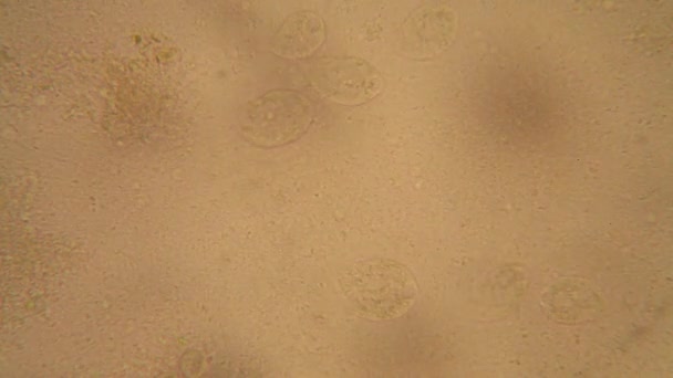 Vista Microscopica Organismi Nell Acqua Arrugginita Con Vegetazione Marcita Paramecium — Video Stock