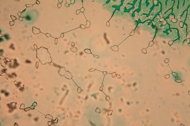 İnsan hücreleri ve mikroskop kurutulmuş renkli su