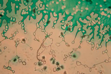 İnsan hücreleri ve mikroskop kurutulmuş renkli su