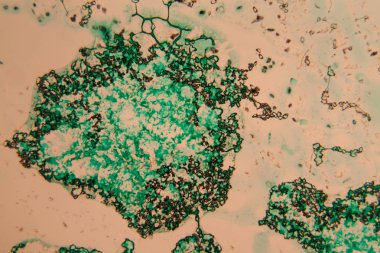 İnsan hücreleri ve mikroskop kurutulmuş renkli su