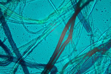 Toz mikroskobik görünümü