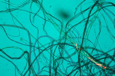 Toz mikroskobik görünümü