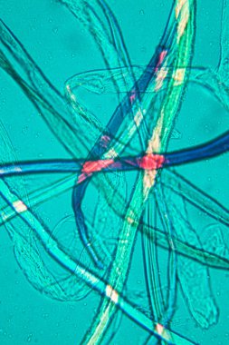 Toz mikroskobik görünümü