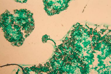 İnsan hücreleri ve mikroskop kurutulmuş renkli su