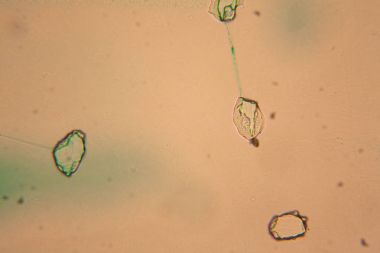 İnsan hücreleri ve mikroskop kurutulmuş renkli su