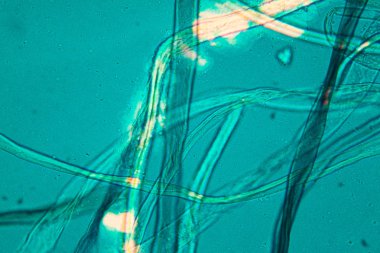 Toz mikroskobik görünümü