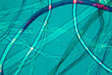 Toz mikroskobik görünümü