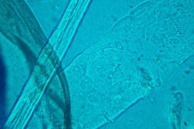 Toz mikroskobik görünümü