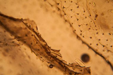 Palomena prasina kanat, mikroskop