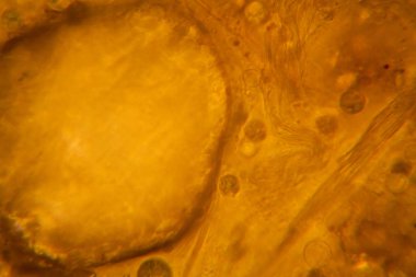 Mikroskop, çürümüş yaprak