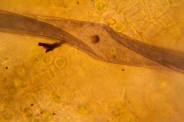 Mikroskop, çürümüş yaprak