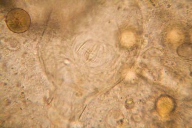 Canlılar arasında köhne su çürümüş bitki örtüsü ile mikroskobik görünümü