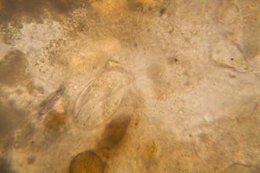 Canlılar arasında köhne su çürümüş bitki örtüsü ile mikroskobik görünümü