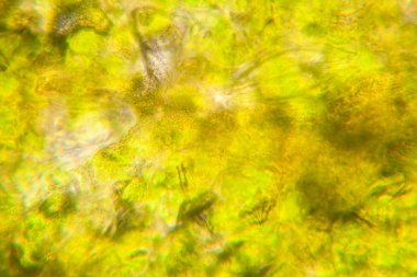 Mikroskop, çürümüş yaprak