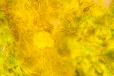 Mikroskop, çürümüş yaprak