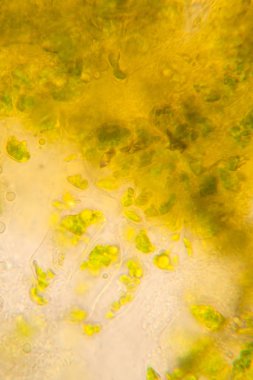 Mikroskop, çürümüş yaprak