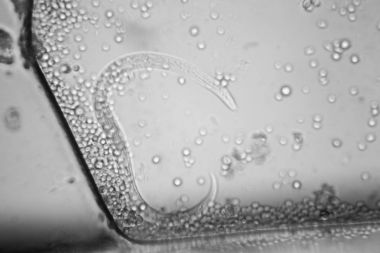 Canlılar arasında köhne su çürümüş bitki örtüsü ile mikroskobik görünümü