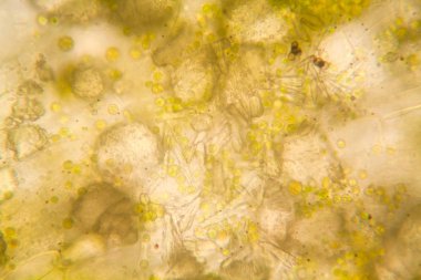 Mikroskop, çürümüş yaprak