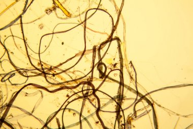 Toz mikroskobik görünümü