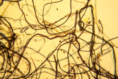 Toz mikroskobik görünümü