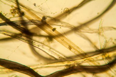 Toz mikroskobik görünümü